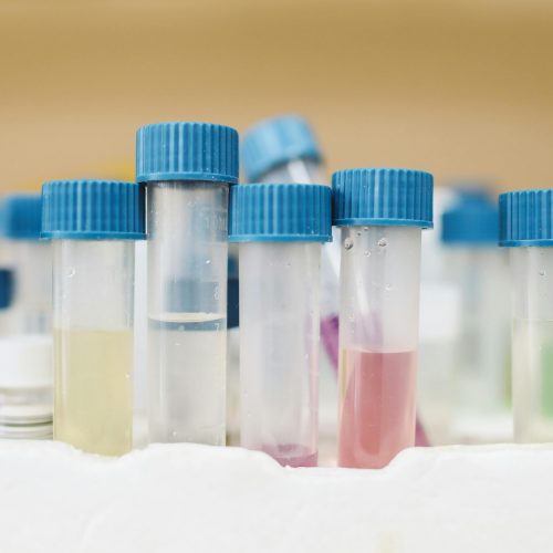Color Assessment in Water Samples