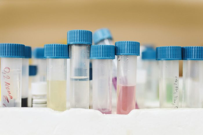 Color Assessment in Water Samples